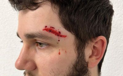 Wound Moulages - Set Standard