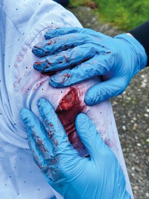 Wound Moulages - Set Standard