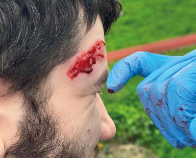 Wound Moulages - Set Standard