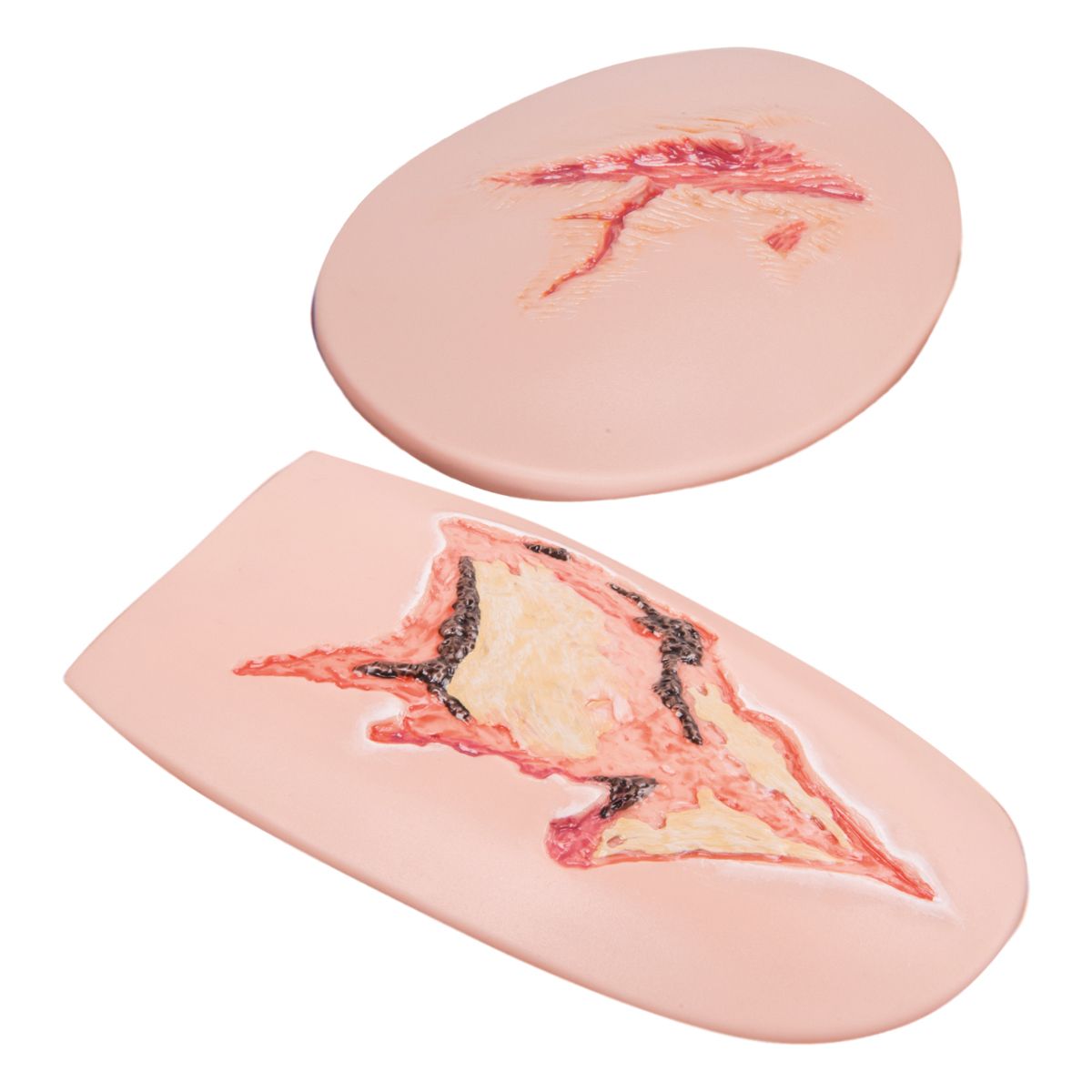 Wound depictions for upper arm and thigh