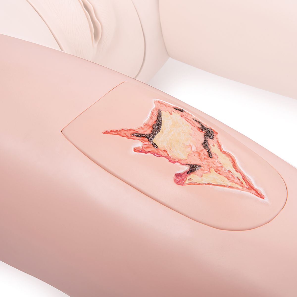 Wound depictions for upper arm and thigh