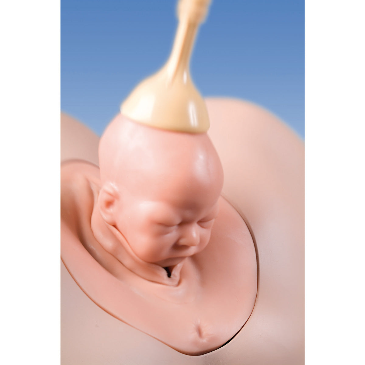 Vacuum Extractor Menox 60mm for SIMone