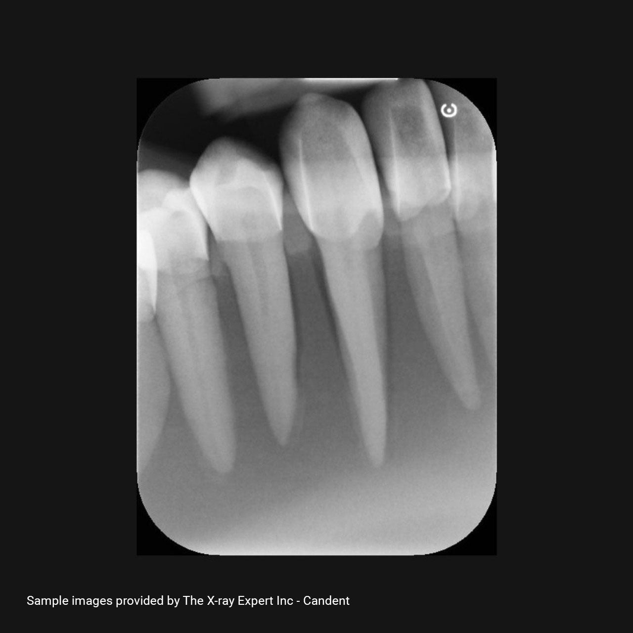 XR Artificial Radiographic Training System