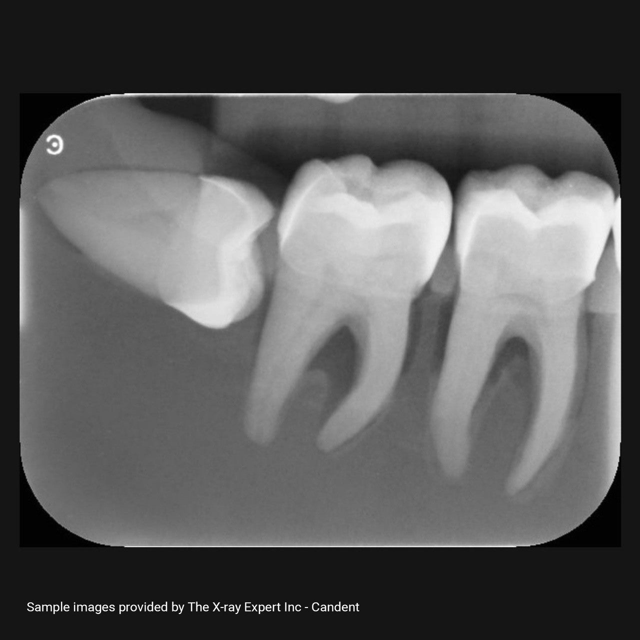 XR Artificial Radiographic Training System