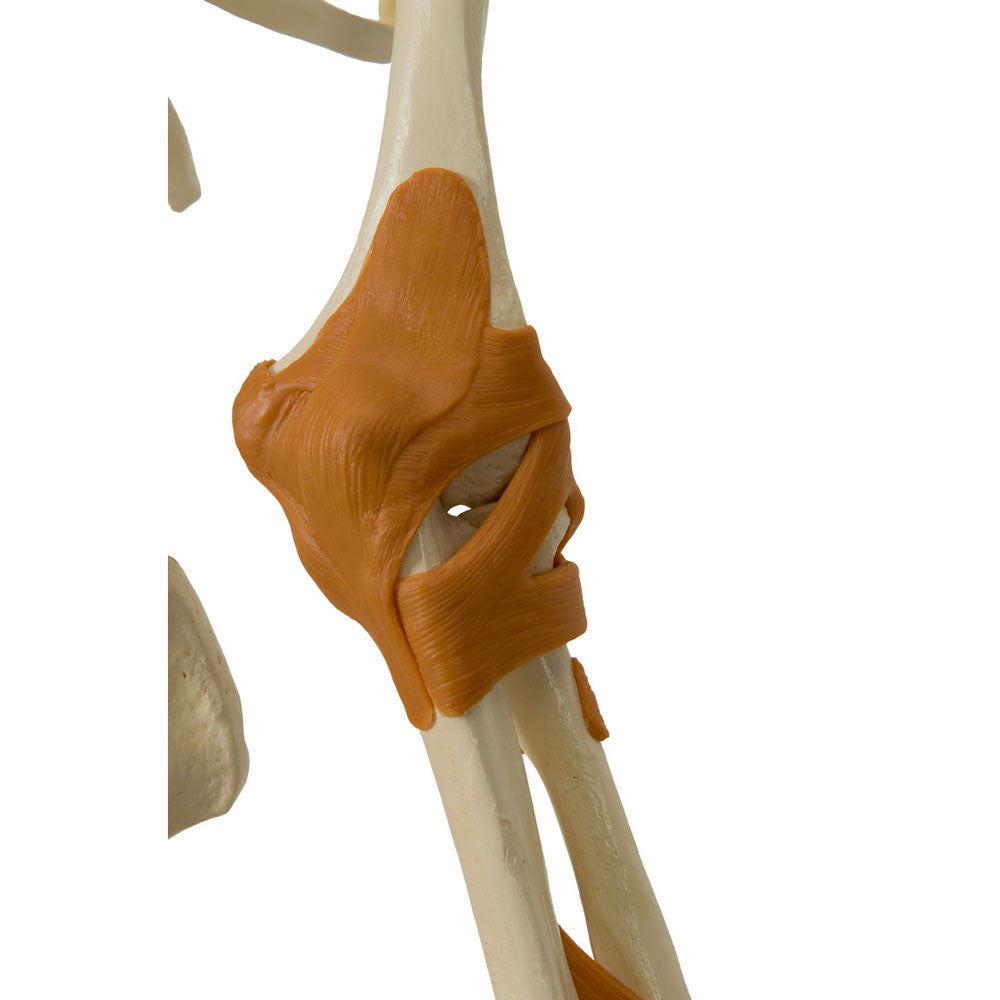Rudiger Super Skeleton - functional ligamented elbow