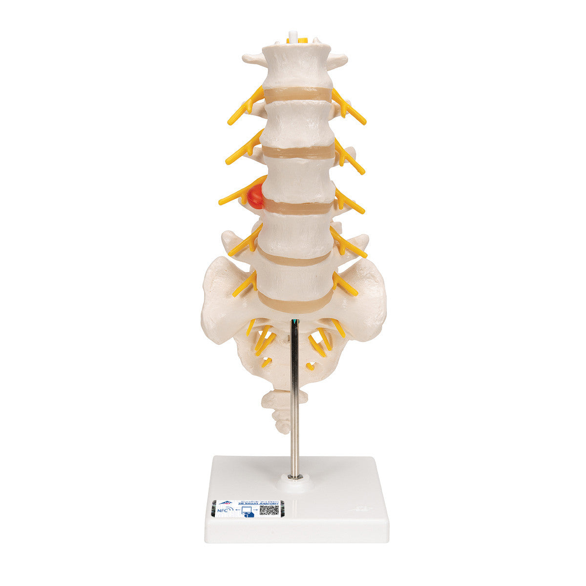 The lumbar model includes a dorso-lateral prolapsed inter-vertebral disc | 3B Scientific A76/5