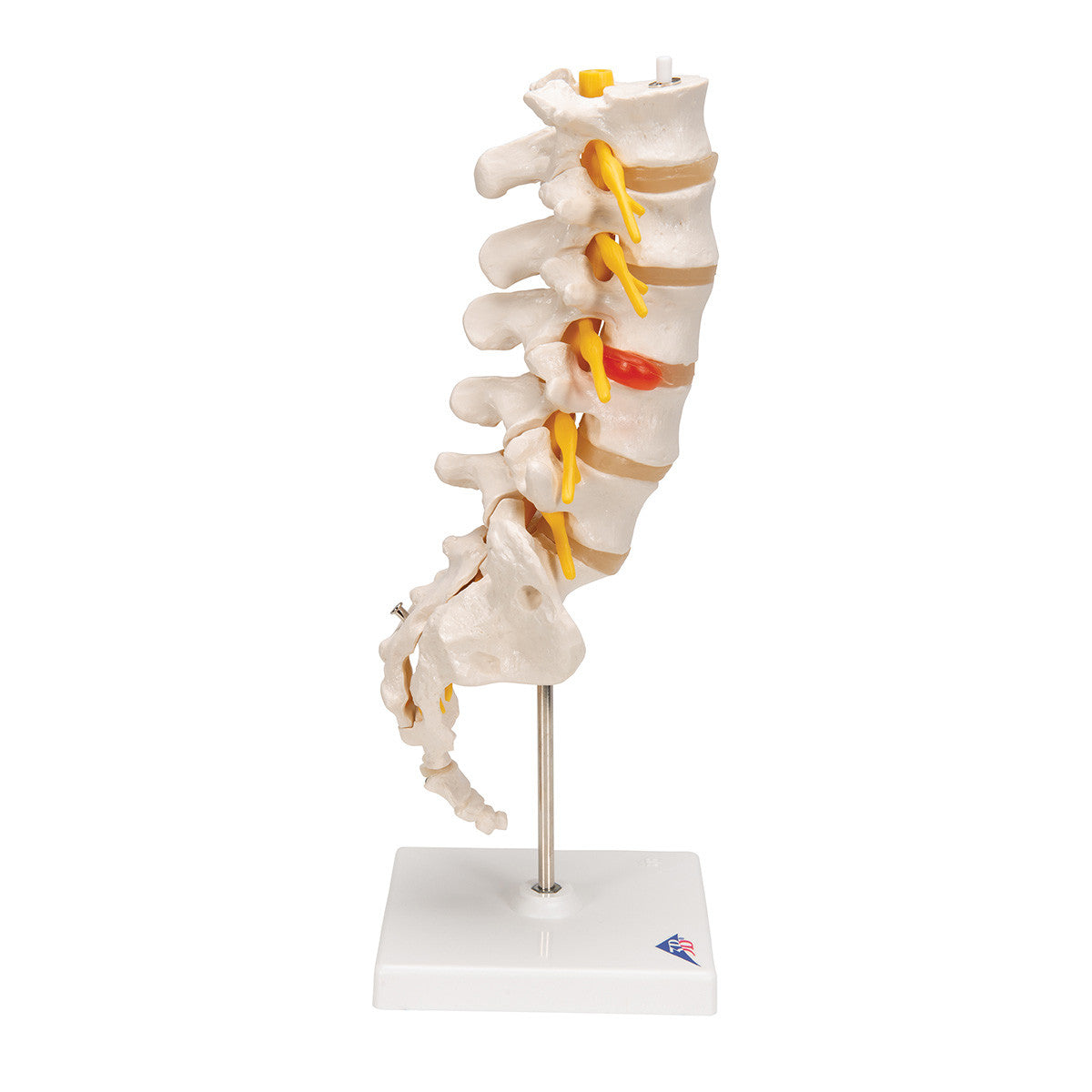 The lumbar model includes a dorso-lateral prolapsed inter-vertebral disc | 3B Scientific A76/5