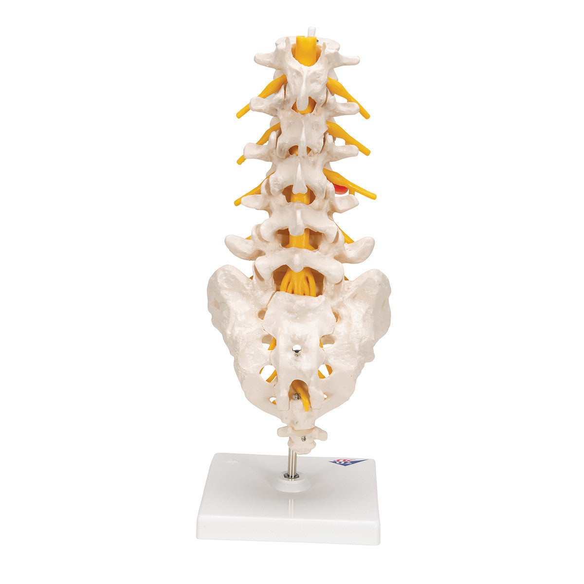 The lumbar model includes a dorso-lateral prolapsed inter-vertebral disc | 3B Scientific A76/5