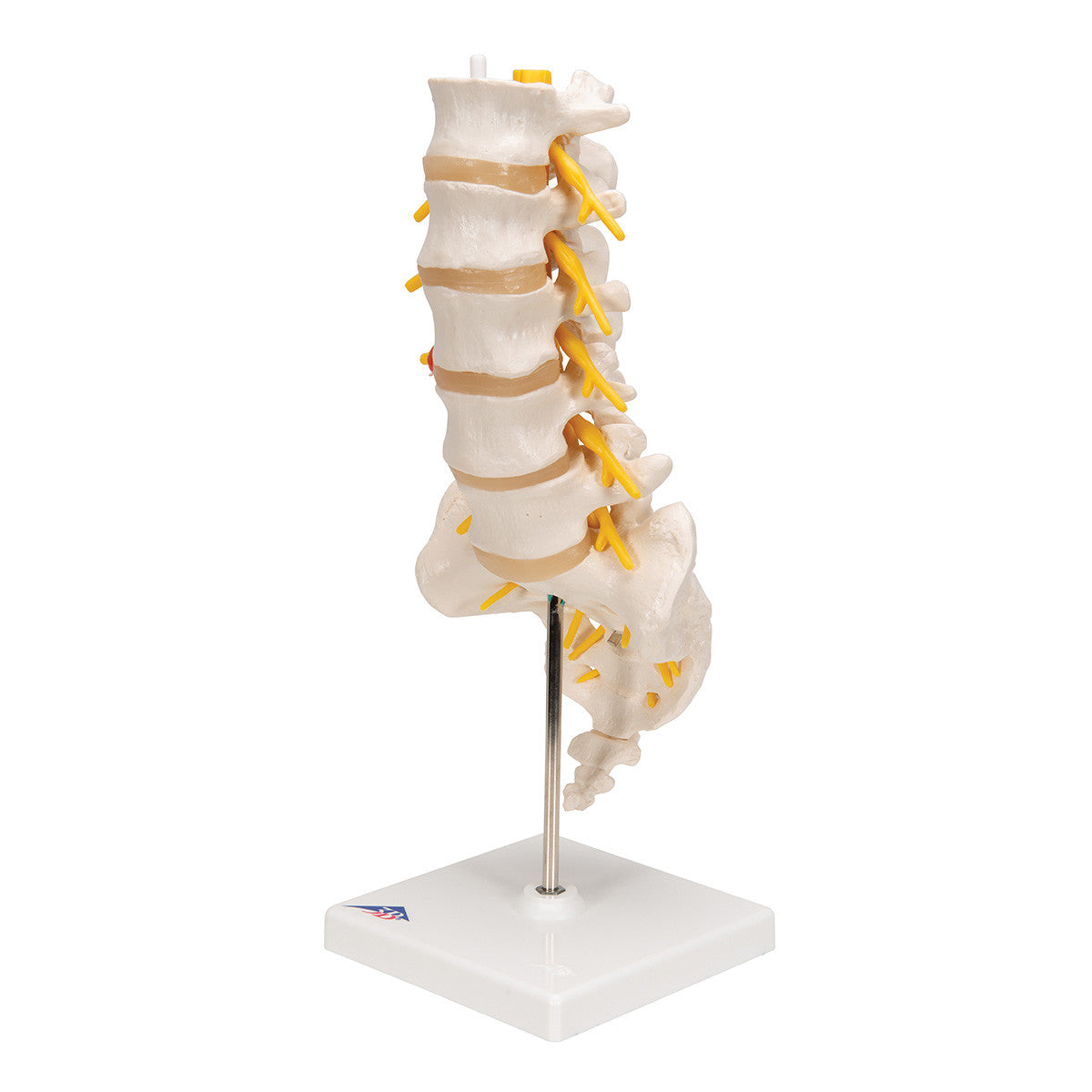 The lumbar model includes a dorso-lateral prolapsed inter-vertebral disc | 3B Scientific A76/5