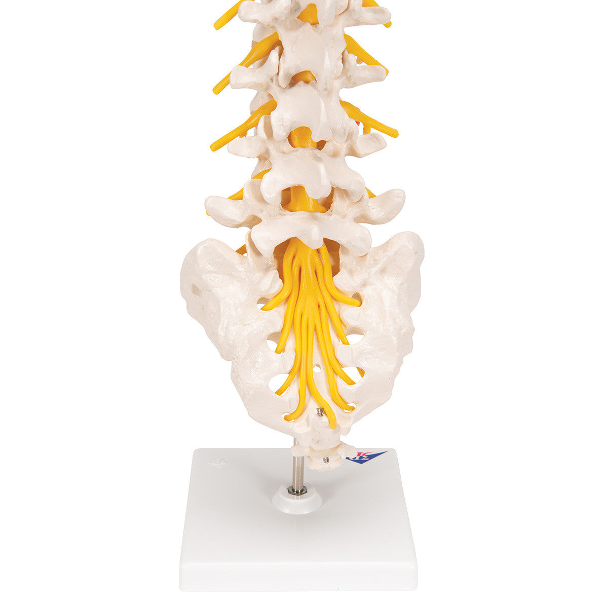 The lumbar model includes a dorso-lateral prolapsed inter-vertebral disc | 3B Scientific A76/5