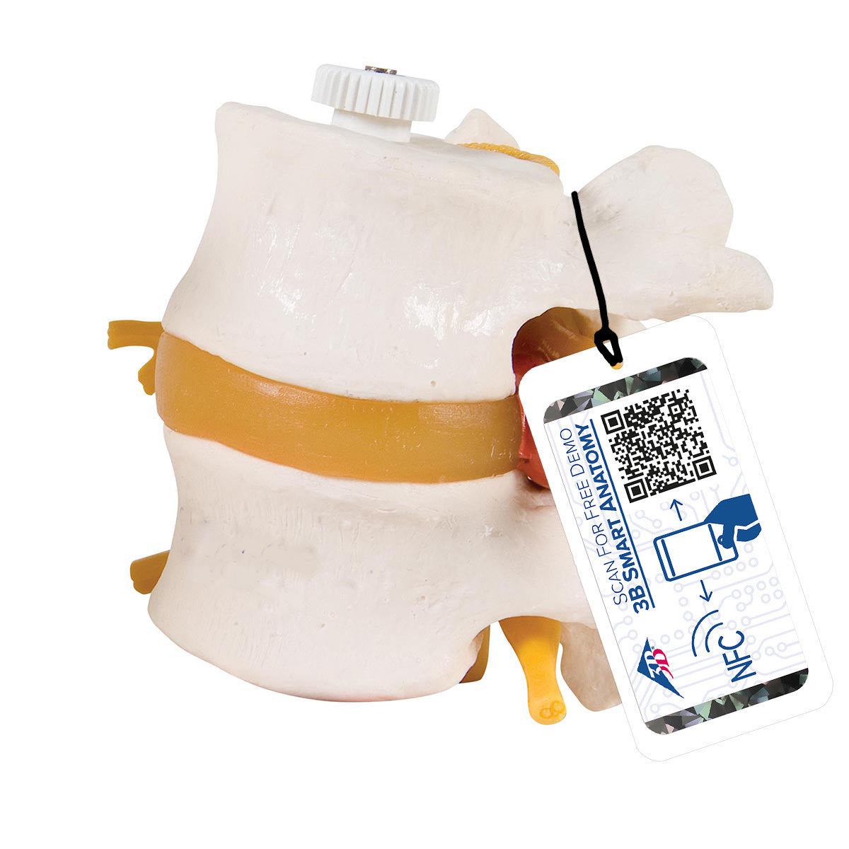 a76-9_01_1200_1200_2-human-lumbar-vertebrae-with-prolapsed-disc-flexibly-mounted-3b-smart-anatomy__09289.1589753127.1280.1280.jpg