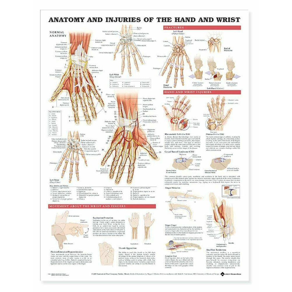 Anatomy and Injuries of the Hand and Wrist Chart
