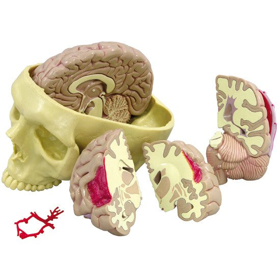 Brain in Base of Skull
