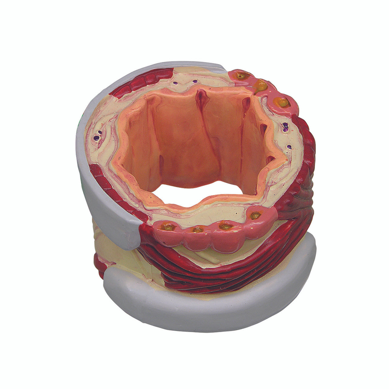 bronchus-model-4a__10492.1642350017.1280.1280.jpg