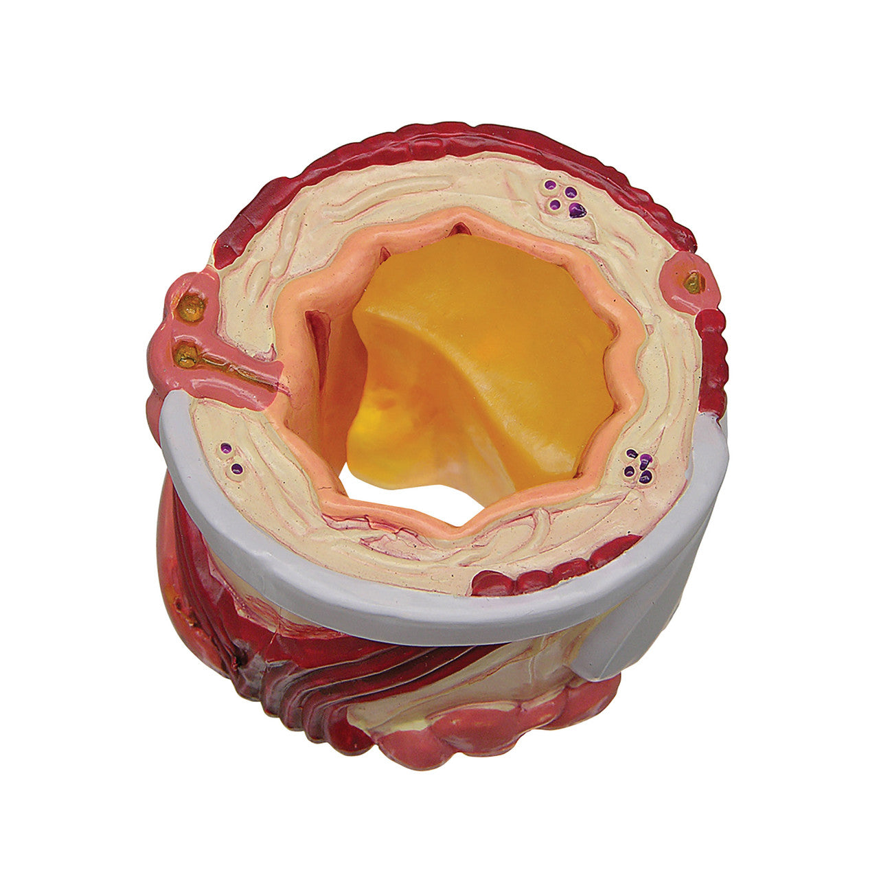 bronchus-model-5a__12113.1642350017.1280.1280.jpg