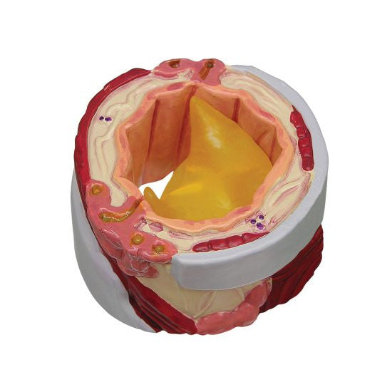 bronchus-model-6a-550x550__14307.1642350016.1280.1280.jpg