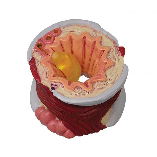 bronchus-model-7a-550x550__24415.1642350016.1280.1280.jpg