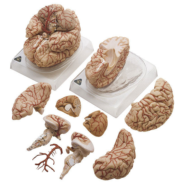 Brain with Arteries Somso Bs 23
