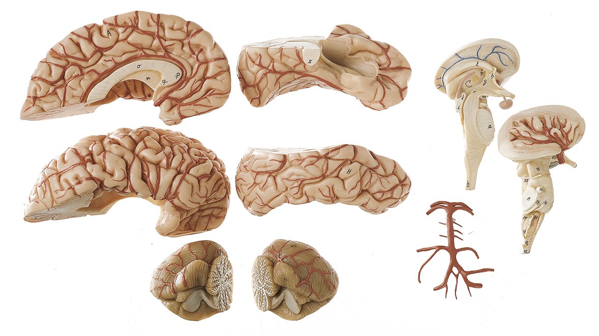 Brain with Arteries
