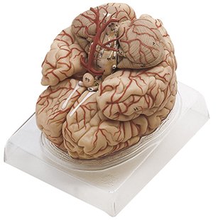 Brain with Arteries