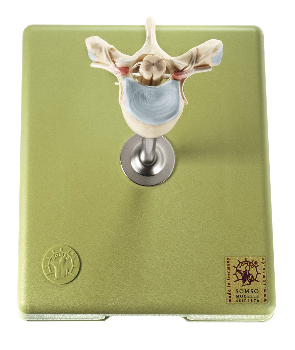 Thoracic Vertebra (TH II) with Spinal Cord