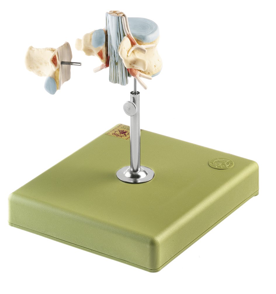 Lumbar Vertebra (L II) with Lumbar Region of Spinal Cord