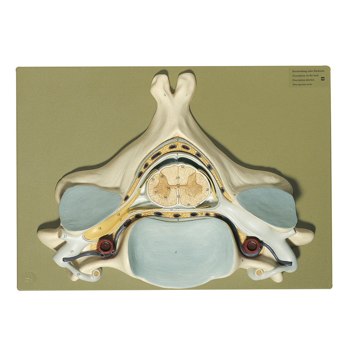Fifth Cervical Vertebra Somso Bs 30
