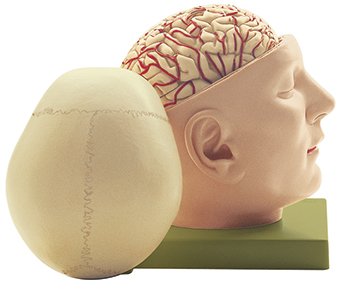 Brain with Base of the Head and Cranial Cap