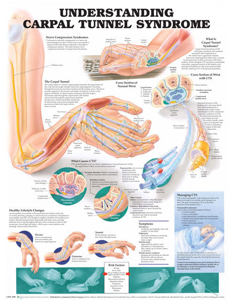 carpal-tunnel_1__06954.1589753276.1280.1280.jpg