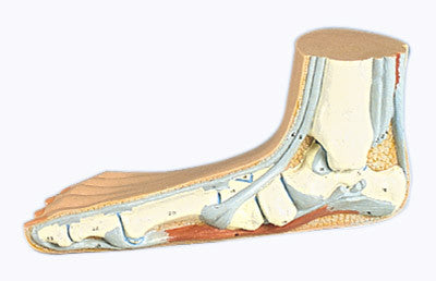 Flat Foot