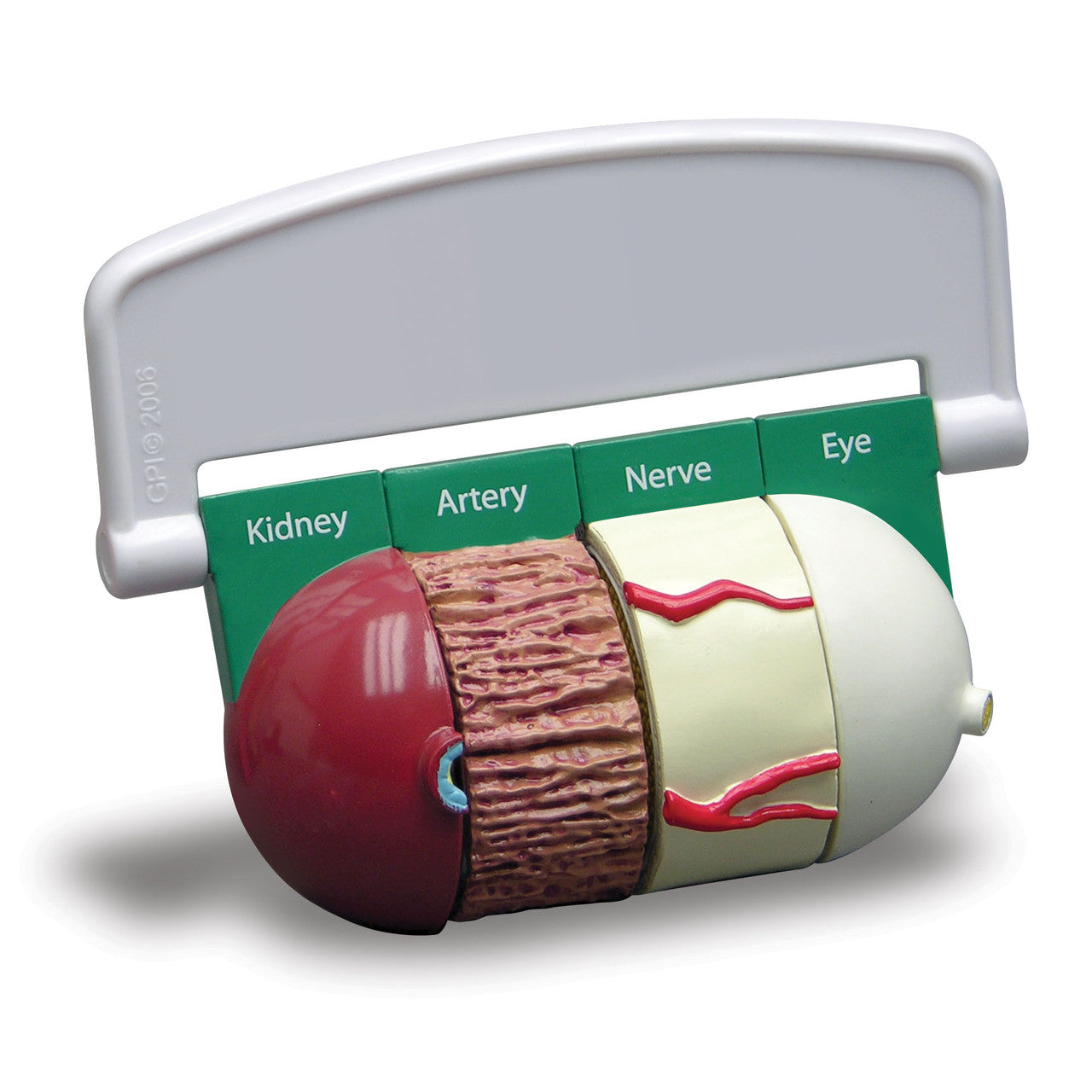 4-Piece Diabetes model - closed