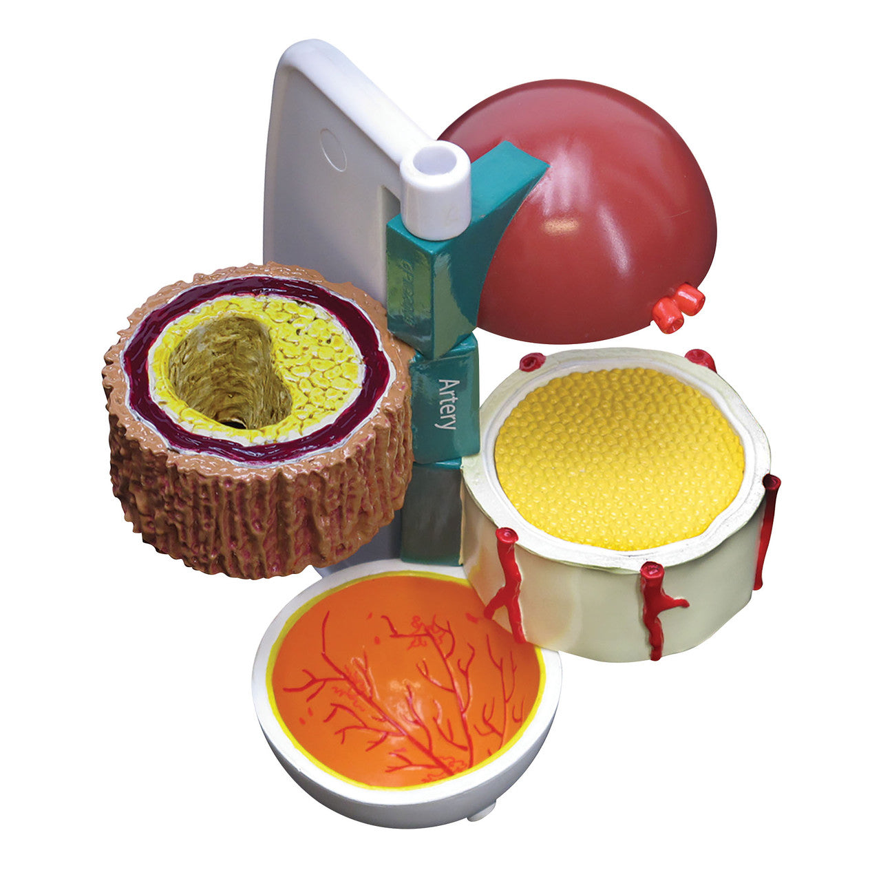 4-Piece Diabetes model