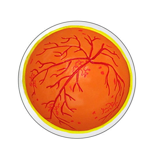 4-Piece Diabetes model - cross section view