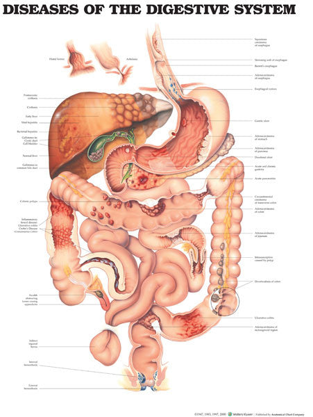 diseases-of-the-digestive-s_1__13494.1589753162.1280.1280.jpg