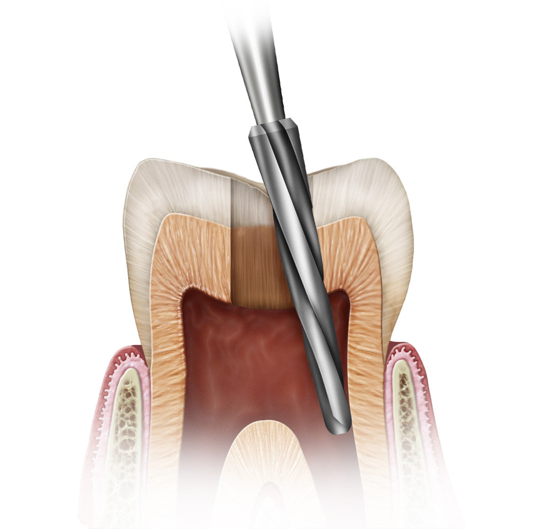 endo_safe_end__88476.1589753209.1280.1280.jpg
