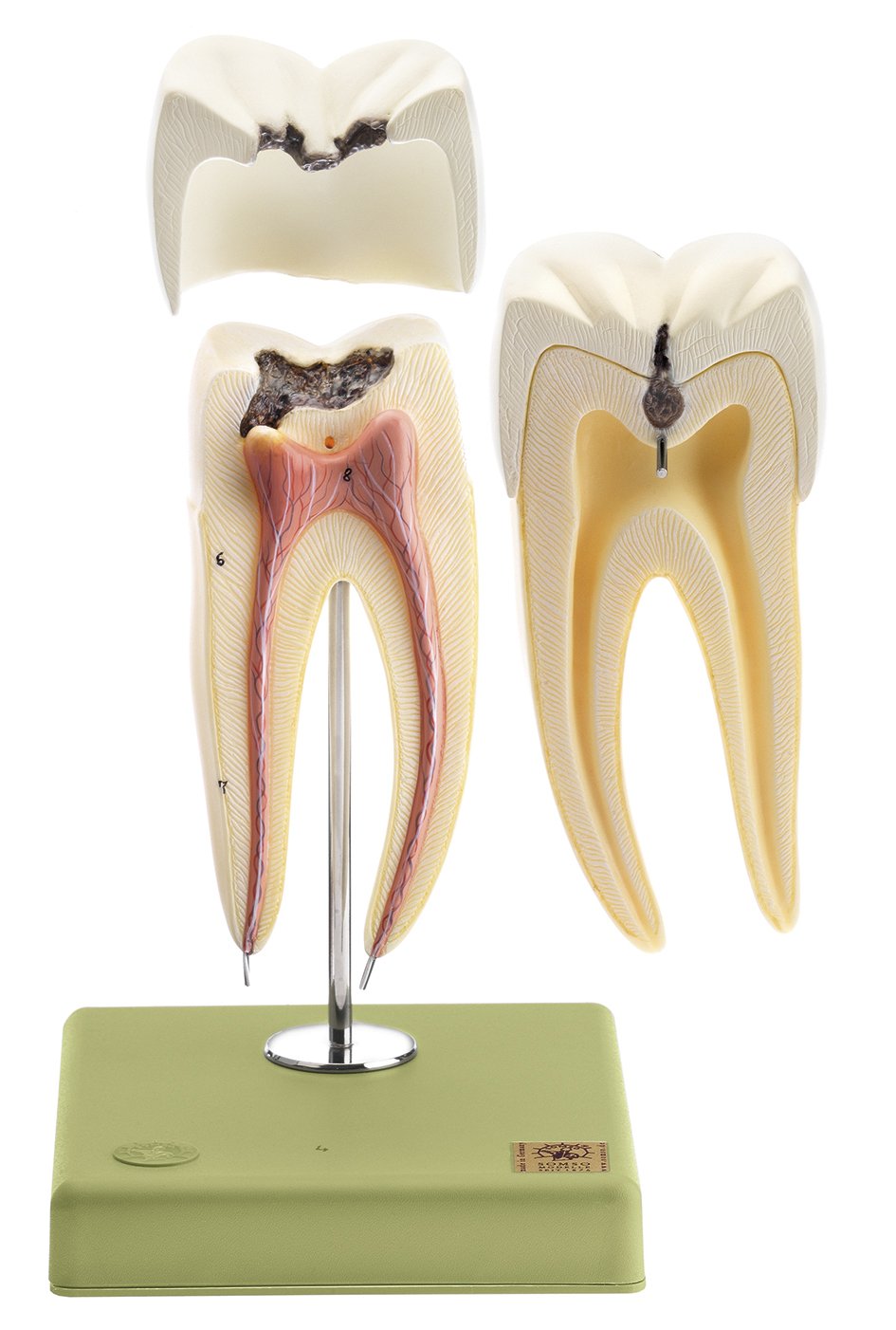 Lower Molar with Two Roots