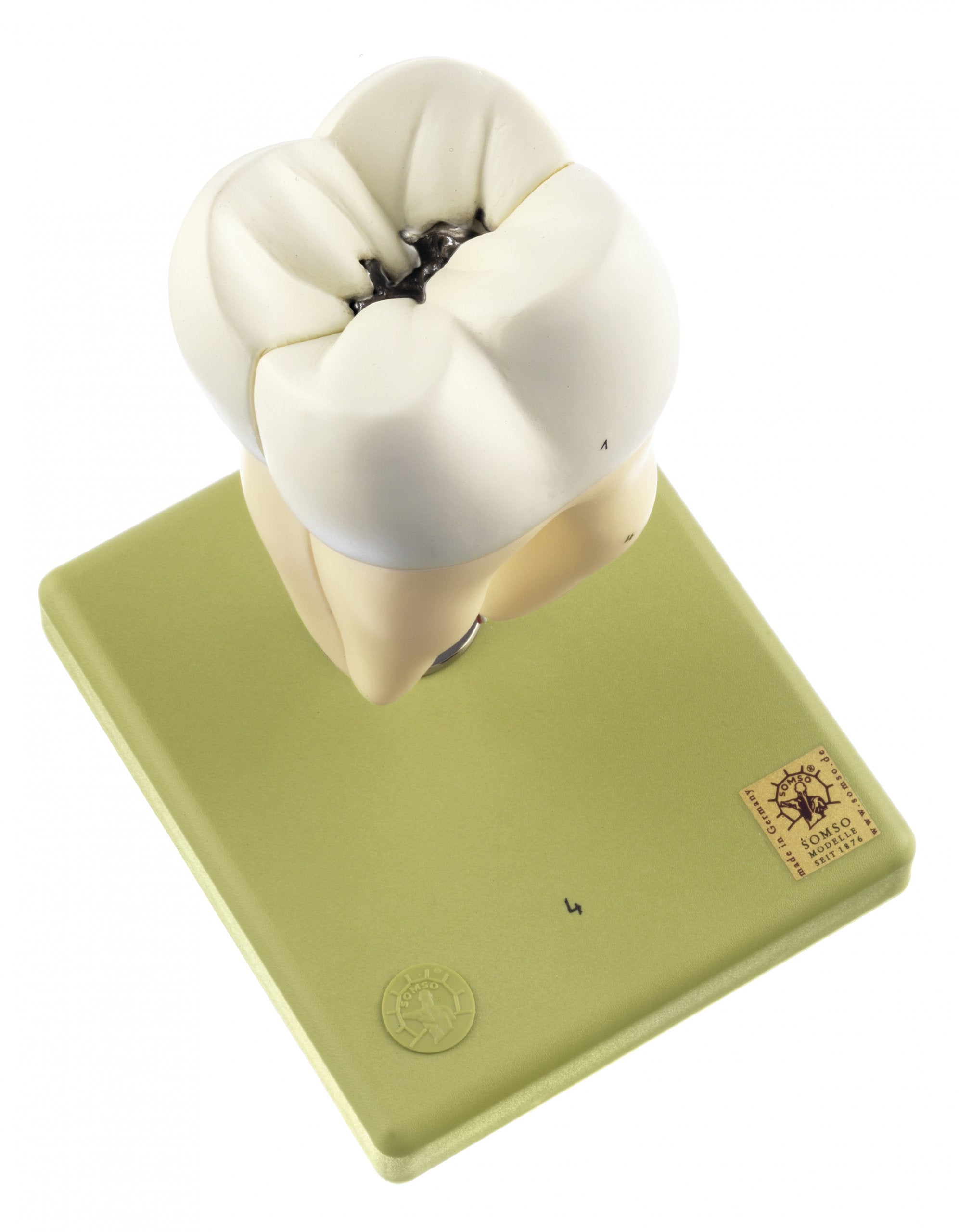 Lower Molar with Two Roots