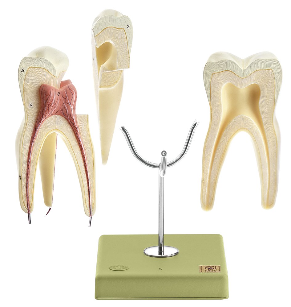 First Upper Molar with Three Roots