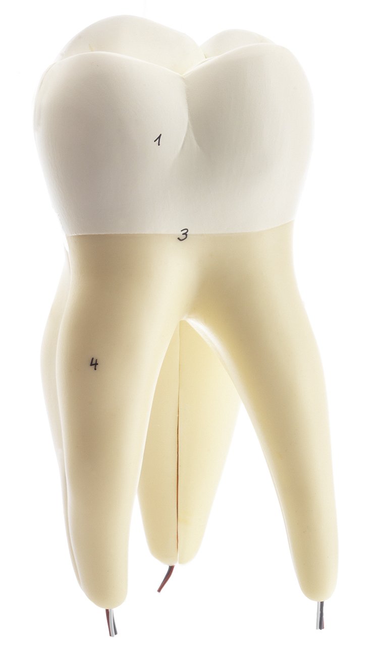 First Upper Molar with Three Roots