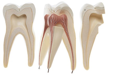 First Upper Molar with Three Roots