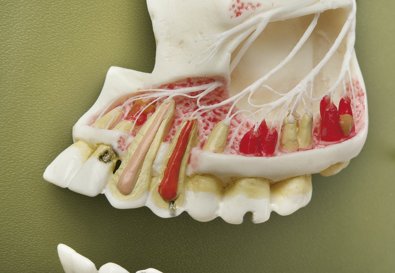 Half of the Upper and Lower Jaw