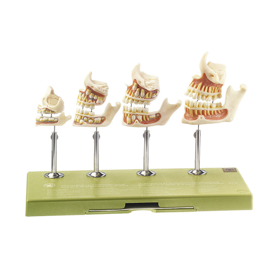 Development of a Set of Teeth Somso Es 14