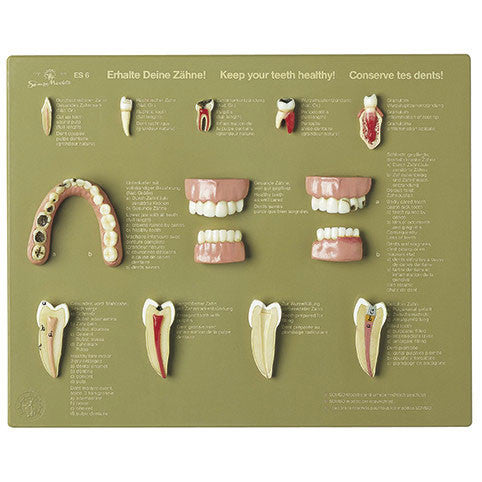Case of Teeth Somso Es 6