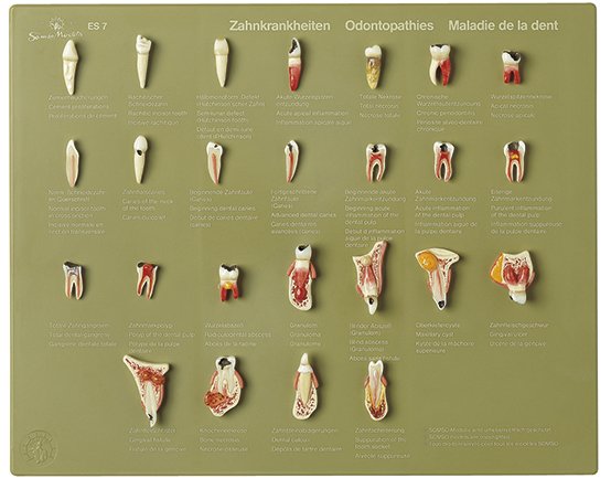 Case of Teeth "Odontopathies"