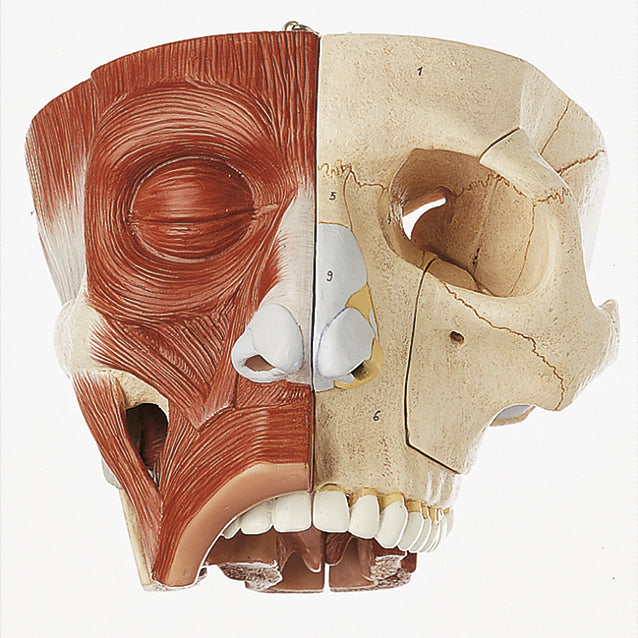 Nose and Nasal Cavities