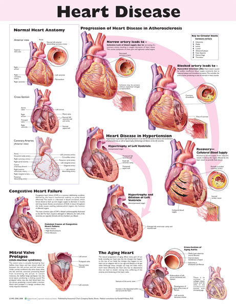 heart-disease-2e_1__78081.1589753289.1280.1280.jpg