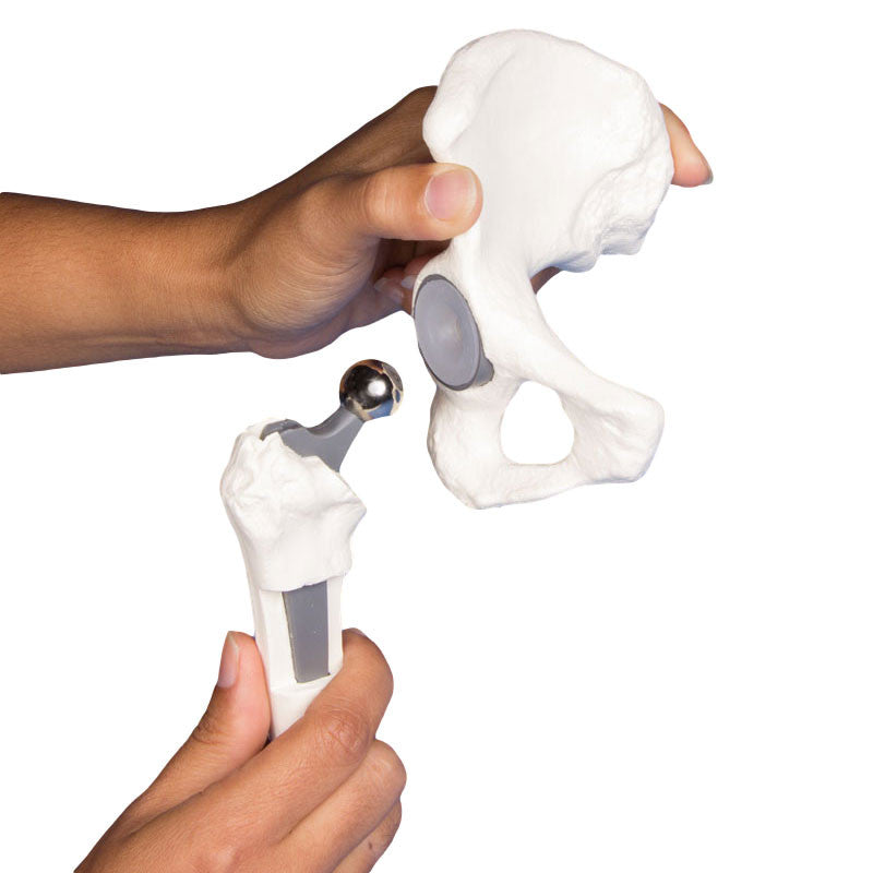Hip Implant Comparison Set - implant