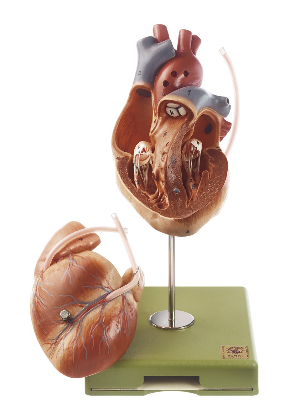 Model of the Heart with Bypass Vessels (Aortic Coronary Venous Bypass)