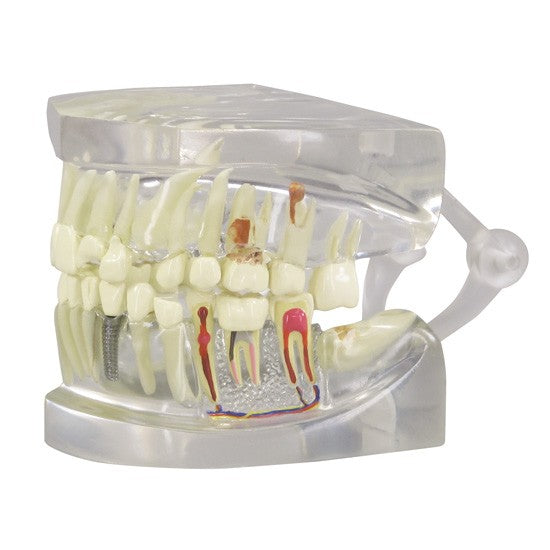 Clear Teeth (Healthy/Pathologies)