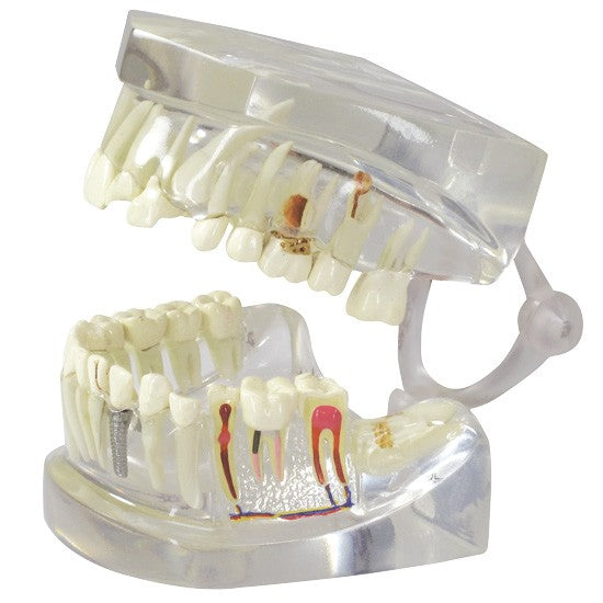 Clear Teeth (Healthy/Pathologies)